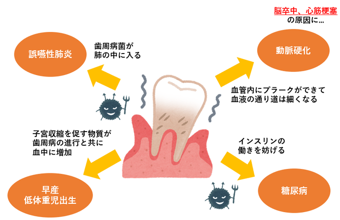 歯周病は万病のもと